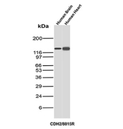 NCAD Antibody Brain and Heart WB. Western blot analysis of N-Cadherin / CDH2 (NCAD) expression in human brain and human heart tissue lysates using NCAD antibody clone CDH2/8815R. Lane 1: human brain lysate, Lane 2: human heart lysate. A band is detected at approximately 120-135 kDa, consistent with the predicted molecular weight of N-Cadherin (CDH2), with the slightly higher apparent migration reflecting known glycosylation of this transmembrane adhesion protein. Strong signal in both brain and heart tissues highlights the role of NCAD as a key adhesion protein in neural and cardiac cell-cell junctions, including synaptic structures and intercalated discs.
