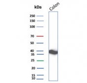 Western blot testing of human colon tissue lysate with CNN1 antibody recombinant mouse mAb. Predicted molecular weight ~34 kDa.