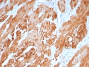 Immunohistochemistry of CNN1 Antibody in human uterus. Formalin-fixed, paraffin-embedded human uterine tissue was stained using the recombinant mouse monoclonal CNN1 antibody (clone rCNN1/6918), demonstrating strong cytoplasmic staining of smooth muscle cells within the myometrium, consistent with Calponin 1 expression in contractile smooth muscle fibers, while endometrial glandular epithelium shows minimal staining. Heat-induced epitope retrieval was performed by boiling tissue sections in pH 9 10mM Tris with 1mM EDTA for 20 minutes followed by cooling prior to testing.