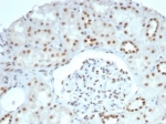 SMARCA4 Antibody Recombinant Rabbit MAb BRG1/6531R. Immunohistochemistry analysis of BRG1 / SMARCA4 in FFPE human kidney tissue demonstrates strong HRP-DAB brown nuclear staining in renal epithelial cells within the kidney tubules, consistent with the nuclear localization of the BRG1 chromatin remodeling ATPase. The staining highlights nuclei of tubular epithelial cells surrounding the glomerulus while the surrounding stromal cells show comparatively weaker nuclear signal. This nuclear staining pattern aligns with the role of SMARCA4 as a core ATP-dependent subunit of the SWI/SNF chromatin remodeling complex involved in transcriptional regulation. Heat induced epitope retrieval was performed by boiling tissue sections in pH 9 10mM Tris buffer with 1mM EDTA for 20 minutes followed by cooling prior to antibody incubation.