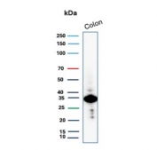 Western blot analysis of Calponin 1 Antibody Recombinant Rabbit MAb in human colon tissue. Lysate from human colon was probed with CNN1/8870R recombinant rabbit monoclonal, demonstrating a prominent band at approximately 34 kDa, consistent with the predicted molecular weight of CNN1. The observed band corresponds to Calponin 1 expressed in smooth muscle cells of the colonic muscularis layer.