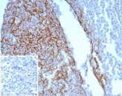 Immunohistochemistry of CD23 Antibody in human tonsil. FFPE human tonsil tissue was stained with CD23 antibody (clone FCER2/8234R). Strong membranous HRP-DAB brown staining is observed in B lymphocytes within germinal centers and mantle zone regions, consistent with known CD23 expression on mature follicular B cells. The staining pattern highlights follicular architecture, with dense positive labeling in B cell rich areas and minimal staining in surrounding T cell predominant interfollicular zones. The inset image shows the PBS negative control processed without primary antibody, demonstrating absence of specific staining. Heat induced epitope retrieval was performed by boiling tissue sections in pH 9 Tris-EDTA buffer for 20 minutes followed by cooling prior to antibody incubation.