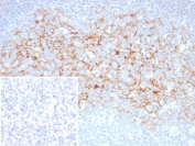Immunohistochemistry of CD23 Antibody in human tonsil. FFPE human tonsil tissue was stained with CD23 antibody rabbit monoclonal FCER2/8510R. Prominent membranous HRP-DAB brown staining is observed in B lymphocytes within germinal centers and mantle zone regions, consistent with established CD23 expression on mature follicular B cells. The staining pattern clearly outlines follicular architecture, with dense positivity in B cell rich areas and minimal staining in adjacent interfollicular T cell zones. The inset image shows the PBS negative control processed without primary antibody, demonstrating absence of specific staining. Heat induced epitope retrieval was performed by boiling tissue sections in pH 9 Tris-EDTA buffer for 20 minutes followed by cooling prior to antibody incubation.