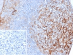 IHC staining of FFPE human tonsil tissue with ICAM-1 antibody (clone ICAM1/6606). Inset: PBS used in place of primary Ab (secondary Ab negative control). HIER: boil tissue sections in pH 9 10mM Tris with 1mM EDTA for 20 min and allow to cool before testing.