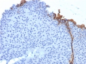 Immunohistochemistry of UPK3B antibody in human bladder tissue. The mouse monoclonal clone UPK3B/3270 demonstrates distinct membranous HRP-DAB brown staining along the apical surface of urothelial umbrella cells, consistent with localization of Uroplakin 3B to differentiated epithelial cell membranes. Staining is concentrated at the luminal interface, highlighting the specialized surface layer of the urothelium, while underlying basal and intermediate cell layers show minimal to absent signal. Surrounding stromal cells remain largely negative, providing clear contrast with positive urothelial elements. Heat-induced epitope retrieval was performed by boiling tissue sections in pH 9 10mM Tris with 1mM EDTA for 20 minutes followed by cooling prior to antibody incubation.