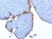 Immunohistochemistry of UPK3B antibody in human bladder tissue. The mouse monoclonal clone UPK3B/3270 shows crisp membranous HRP-DAB brown staining along the apical surface of urothelial umbrella cells lining the bladder lumen. The staining pattern highlights the luminal cell borders and specialized apical membranes, consistent with localization of Uroplakin 3B in differentiated superficial urothelial cells. Basal and intermediate cell layers display little to no specific staining, and adjacent stromal components are largely negative, providing clear contrast with the positively labeled surface epithelium. Heat-induced epitope retrieval was performed by boiling tissue sections in pH 9 10mM Tris with 1mM EDTA for 20 minutes followed by cooling prior to antibody incubation.