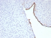 Immunohistochemistry of Uroplakin 3B antibody in human bladder tissue. The recombinant rabbit mAb clone UPK3B/8768R demonstrates distinct membranous HRP-DAB brown staining along the apical surface of urothelial umbrella cells lining the bladder lumen. The staining pattern highlights the specialized luminal membrane of differentiated superficial urothelial cells, while underlying intermediate and basal cell layers show minimal to absent signal. Stromal cells and surrounding connective tissue remain largely negative, providing clear contrast with the positively labeled epithelial surface. Heat-induced epitope retrieval was performed by boiling tissue sections in pH 9 10mM Tris with 1mM EDTA for 20 minutes followed by cooling prior to antibody incubation.