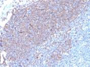 IHC staining of FFPE human tonsil tissue with CD79a antibody (clone rIGA/6986). HIER: boil tissue sections in pH 9 10mM Tris with 1mM EDTA for 20 min and allow to cool before testing.