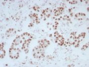 ERCC1 Antibody Bladder Tissue IHC. Immunohistochemistry analysis of FFPE human bladder tissue stained with ERCC1 Antibody (clone ERCC1/7597) demonstrates strong HRP-DAB brown nuclear staining in epithelial cells, consistent with ERCC1 involvement in DNA repair processes and its distribution across tissue compartments, while surrounding stromal cells show lower background; antigen retrieval was performed in pH 9 Tris-EDTA buffer.