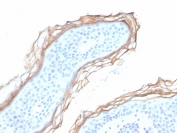 Kallikrein 5 Antibody Epidermal Keratinocyte IHC. Immunohistochemistry staining of FFPE human skin tissue with Kallikrein 5 antibody (clone KLK5/3855). HIER: boil tissue sections in pH 9 10mM Tris with 1mM EDTA for 20 min and allow to cool before testing.