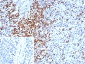 Immunohistochemistry analysis of CD2 antibody (clone LFA2/8681R) in human spleen tissue. Formalin-fixed, paraffin-embedded spleen demonstrates strong membranous HRP-DAB brown staining in lymphoid areas, consistent with CD2 expression on mature T lymphocytes within periarteriolar lymphoid sheaths. Surrounding splenic white pulp shows prominent positive T cell populations, while non-lymphoid stromal regions exhibit minimal staining. Hematoxylin counterstain clearly delineates nuclear morphology and splenic architecture. The inset shows PBS used in place of primary antibody as a negative control, confirming absence of non-specific secondary antibody binding. Heat-induced epitope retrieval was performed by boiling tissue sections in 10 mM Tris with 1 mM EDTA, pH 9.0, for 20 minutes followed by cooling prior to staining.