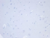 Negative control: IHC testing of FFPE human brain tissue with NAPSA antibody (clone NAPSA/7165R) at 2ug/ml. HIER: boil tissue sections in pH 9 10mM Tris with 1mM EDTA for 20 min and allow to cool before testing.
