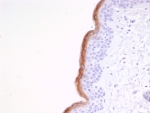 KLK7 Antibody - Protein Microarray Validated clone KLK7/4691 immunohistochemistry analysis of Kallikrein 7 / KLK7 in human skin tissue. FFPE human skin tissue was stained with KLK7 Antibody - Protein Microarray Validated (clone KLK7/4691) following heat induced epitope retrieval by boiling tissue sections in pH 9 Tris-EDTA buffer (10mM Tris, 1mM EDTA) for 20 minutes prior to cooling and staining. HRP-DAB brown chromogenic signal highlights strong staining along the outer epidermal layers of keratinocytes near the stratum corneum, consistent with the known localization of Kallikrein 7 (KLK7), also known as stratum corneum chymotryptic enzyme, in differentiated epidermal cells involved in skin barrier turnover and desquamation. Detection of KLK7 expression by immunohistochemistry supports studies of epidermal differentiation, keratinocyte biology, and dermatological disease research.