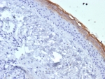 Kallikrein 7 Antibody immunohistochemistry analysis of KLK7 in human skin tissue using clone KLK7/4692. FFPE human skin tissue was stained with Kallikrein 7 antibody clone KLK7/4692 following heat induced epitope retrieval by boiling tissue sections in pH 9 Tris-EDTA buffer (10mM Tris, 1mM EDTA) for 20 minutes prior to cooling and staining. HRP-DAB brown chromogenic signal highlights strong staining along the outer epidermal layers near the stratum corneum, consistent with the known localization of Kallikrein 7 (KLK7), also known as stratum corneum chymotryptic enzyme, in differentiated keratinocytes involved in epidermal turnover and desquamation. Detection of KLK7 expression by immunohistochemistry supports studies of epidermal differentiation and keratinocyte biology using Kallikrein 7 Antibody / KLK7 (clone KLK7/4692).