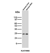 KLK7 Antibody for WB western blot analysis of Kallikrein 7 in human tissue lysates. Lane 1: human liver lysate, Lane 2: human skin lysate. Samples were resolved by SDS-PAGE and probed with Kallikrein 7 antibody clone KLK7/4692 followed by detection with an appropriate secondary antibody. A band is detected at approximately 28-30 kDa, consistent with the predicted molecular weight of Kallikrein 7 (KLK7), a secreted serine protease also known as stratum corneum chymotryptic enzyme that is primarily expressed in epidermal keratinocytes. The stronger signal observed in human skin lysate aligns with the known enrichment of KLK7 in epidermal tissue involved in skin barrier function and desquamation. Detection of KLK7 expression supports use of Kallikrein 7 Antibody / KLK7 (clone KLK7/4692) for western blot analysis of KLK7 protein in human tissue samples.