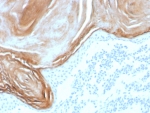 Kallikrein 7 Antibody Recombinant Rabbit MAb KLK7/8971R immunohistochemistry analysis of Kallikrein 7 / KLK7 in human skin tissue. FFPE human skin tissue was stained with Kallikrein 7 Antibody Recombinant Rabbit MAb clone KLK7/8971R following heat induced epitope retrieval by boiling tissue sections in pH 9 Tris-EDTA buffer (10mM Tris, 1mM EDTA) for 20 minutes prior to cooling and staining. HRP-DAB brown chromogenic signal highlights strong staining in the outer epidermal layers near the stratum corneum where differentiated keratinocytes are present, consistent with the known localization of Kallikrein 7 (KLK7), also known as stratum corneum chymotryptic enzyme, in epidermal structures involved in desquamation and skin barrier turnover. Detection of KLK7 expression by immunohistochemistry supports studies of epidermal differentiation, keratinocyte biology, and dermatological disease research using Kallikrein 7 Antibody Recombinant Rabbit MAb (clone KLK7/8971R).