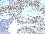 KIF2C Antibody Testis IHC. Immunohistochemistry analysis of Kinesin like protein 6 / KIF2C expression in FFPE human testis tissue using KIF2C Antibody, clone KIF2C/4705 at 2 ug/ml. The KIF2C Antibody shows strong nuclear and cytoplasmic HRP-DAB brown staining in spermatogenic cells within seminiferous tubules, while surrounding interstitial tissue displays reduced signal; nuclei are counterstained blue. Inset: PBS used in place of primary antibody to control for secondary antibody binding. This Microarray Specificity Validated Antibody supports highly specific detection of KIF2C in proliferative germ cell populations. Antigen retrieval was performed by boiling tissue sections in 10 mM Tris buffer with 1 mM EDTA, pH 9, for 20 min followed by cooling at room temperature.