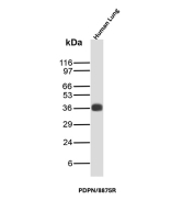 Glycoprotein 36 Antibody Lung WB. Western blot analysis of Glycoprotein 36 / PDPN expression in human lung tissue lysate using recombinant Glycoprotein 36 antibody, clone PDPN/8875R. Lane 1: human lung tissue lysate. A band is detected at approximately 36-40 kDa, consistent with the predicted molecular weight of PDPN, with migration influenced by glycosylation characteristic of this membrane-associated sialoglycoprotein.