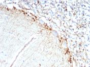GLUL Antibody Recombinant Mouse MAb Brain IHC. Immunohistochemistry of GLUL Antibody Recombinant Mouse MAb rGLUL/8620 in human brain tissue. Formalin-fixed, paraffin-embedded human brain sections demonstrate cytoplasmic HRP-DAB brown staining in glial cell populations consistent with Glutamate-ammonia ligase (Glutamine synthetase) localization. Staining is observed along the neuropil and in astrocytic cell bodies, while neuronal nuclei remain unstained. Heat-induced epitope retrieval was performed by boiling tissue sections in pH 9 10 mM Tris with 1 mM EDTA for 20 min followed by cooling prior to antibody incubation.