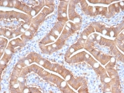 S100A16 Antibody Intestinal Epithelium IHC. Immunohistochemistry of S100 calcium binding protein A16 / S100A16 in FFPE human duodenum tissue using mouse monoclonal S100A16 antibody, clone S100A16/7411. HRP-DAB brown staining highlights strong cytoplasmic and membranous labeling of enterocytes lining villous structures, consistent with epithelial differentiation, while lamina propria cells show minimal staining and nuclei are counterstained blue. Heat induced epitope retrieval was performed by boiling tissue sections in pH 9 10 mM Tris with 1 mM EDTA for 20 min followed by cooling prior to staining.