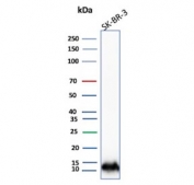 S100A16 Antibody SK-BR-3 WB. Western blot analysis of S100 calcium binding protein A16 / S100A16 in human SK-BR-3 cell lysate using S100A16 antibody. A band is detected at approximately 10-12 kDa, consistent with the predicted molecular weight of S100A16, supporting detection of this small calcium-binding protein in epithelial-derived cells.