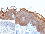 S100A16 Antibody Proliferative Epidermis IHC. Immunohistochemistry of S100 calcium binding protein A16 / S100A16 in FFPE human skin tissue using mouse monoclonal S100A16 antibody, clone S100A16/7412. HRP-DAB brown staining highlights prominent cytoplasmic and membranous labeling of keratinocytes within the epidermis, with increased intensity in basal and suprabasal layers consistent with proliferative and tumor-associated epithelial signaling, while the underlying dermis shows minimal staining and nuclei are counterstained blue. Inset: PBS was used in place of primary antibody as a negative control to confirm specificity of staining. Heat induced epitope retrieval was performed by boiling tissue sections in pH 9 10 mM Tris with 1 mM EDTA for 20 min followed by cooling prior to staining.