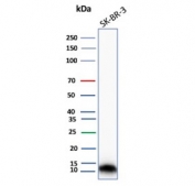 S100A16 Antibody Proliferation Marker WB. Western blot analysis of S100 calcium binding protein A16 / S100A16 in human SK-BR-3 cell lysate using S100A16 antibody, clone S100A16/7412. A band is detected at approximately 10-12 kDa, consistent with the predicted molecular weight of S100A16, supporting detection of this calcium-binding protein in proliferative epithelial-derived tumor cells.