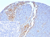 CD64 Antibody Tonsil IHC. Immunohistochemistry staining of FFPE human tonsil with CD64 antibody (clone FCGR1A/7496) at 2ug/ml. Inset: PBS used in place of primary Ab (secondary Ab negative control). HIER: boil tissue sections in pH 9 10mM Tris with 1mM EDTA for 20 min and allow to cool before testing.