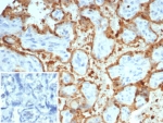 S100A12 Antibody / EN-RAGE Antibody (clone S100A12/4514) in human placental tissue. Immunohistochemistry staining of FFPE human placenta demonstrates cytoplasmic staining in scattered inflammatory cells consistent with the known expression of S100 calcium binding protein A12 / S100A12 in neutrophils and other myeloid-derived cells. Brown chromogenic signal highlights S100A12-positive inflammatory cells within placental tissue while surrounding trophoblastic and stromal cells remain largely negative. The inset shows PBS used in place of primary antibody as a secondary-only negative control. Heat-induced epitope retrieval was performed by boiling tissue sections in pH 9 Tris buffer with 1 mM EDTA for 20 min before staining.