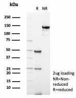 SDS-PAGE analysis of purified, BSA-free S100A12/EN-RAGE antibody (clone S100A12/4514) as confirmation of integrity and purity.