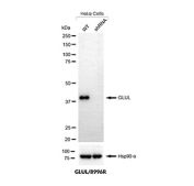 Glutamine Synthetase Antibody Knockdown Validation WB. Western blot analysis of GLUL expression in wild-type (WT) and GLUL shRNA knockdown HeLa cells using Glutamine Synthetase antibody clone GLUL/8996R. Lane 1: WT lysate, Lane 2: knockdown lysate. The band at approximately 40-45 kDa is reduced in knockdown cells, supporting target-specific detection. Hsp90 alpha serves as a loading control.