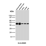 Glutamine Synthetase Antibody Multi-Sample Tissue WB. Western blot analysis of GLUL expression in human brain tissue, human liver tissue, HeLa cells, Jurkat cells, and Y79 cells using Glutamine Synthetase antibody clone GLUL/8996R. A band is detected at approximately 40-45 kDa across all samples, consistent with the predicted molecular weight of glutamine synthetase and reflecting its broad expression in metabolically active tissues and cell lines.