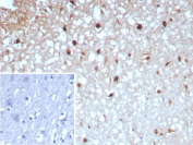 Glutamine Synthetase Antibody Brain Tissue IHC. Immunohistochemical analysis of GLUL expression in formalin-fixed, paraffin-embedded human brain tissue using Glutamine Synthetase antibody clone GLUL/8996R. Diffuse cytoplasmic HRP-DAB brown staining highlights glial cell populations and astrocytic processes throughout the neuropil, consistent with the role of glutamine synthetase in neurotransmitter metabolism. Inset: PBS was used in place of the primary antibody as a negative control, showing absence of specific staining and confirming signal specificity. HIER: boil tissue sections in pH 9 10mM Tris with 1mM EDTA for 20 min followed by cooling prior to staining.