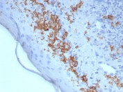 CD1A Antibody for IHC. Immunohistochemistry analysis of CD1A / CD1a expression in FFPE human skin tissue using CD1A Antibody. Membranous and cytoplasmic staining is observed in dendritic cells within the epidermis and superficial dermis, consistent with Langerhans cell localization, while surrounding keratinocytes remain largely negative. The presence of CD1a-positive cells at the epithelial interface reflects immune cell infiltration and supports evaluation of antigen-presenting dendritic cells within tissue microenvironments. HIER: boil tissue sections in pH 9 10 mM Tris with 1 mM EDTA for 20 minutes and allow to cool before testing.