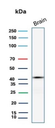 GLUL Antibody Brain WB. Western blot analysis of human brain lysate using Glutamine synthetase Antibody clone GLUL/6601. A distinct band is detected at approximately 42-45 kDa, consistent with the predicted molecular weight of Glutamate-ammonia ligase / GLUL, a metabolic enzyme that catalyzes glutamine synthesis and plays an essential role in nitrogen metabolism and glutamate-glutamine cycling within neural tissue.