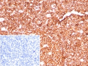 Immunohistochemistry analysis of CD45RA antibody (clone PTPRC/8699R) in human tonsil tissue. FFPE human tonsil demonstrates strong membranous staining of lymphoid cells within follicular and interfollicular regions, consistent with CD45RA surface expression. The inset negative control, using PBS in place of the primary antibody, shows no specific staining. Heat-induced epitope retrieval was performed by boiling sections in pH 9 10mM Tris with 1mM EDTA for 20 minutes followed by cooling prior to staining.