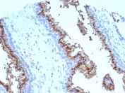 Prostein Antibody for IHC. Immunohistochemistry analysis of Prostein / SLC45A3 antibody staining in FFPE human prostate tissue using clone SLC45A3/7647. Strong cytoplasmic and perinuclear staining is observed in prostate glandular epithelial cells lining luminal structures, consistent with Golgi-associated localization of Prostein, while surrounding stromal cells remain negative. The staining highlights epithelial cell polarity and intracellular compartmentalization associated with solute carrier transport function within the secretory pathway. Heat-induced epitope retrieval was performed in pH 9 Tris-EDTA buffer for 20 minutes followed by cooling prior to antibody incubation.