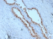Prostein Antibody for IHC. Immunohistochemistry analysis of Prostein / SLC45A3 antibody staining in FFPE human prostate tissue using clone SLC45A3/7650. Strong cytoplasmic and perinuclear staining is observed in prostate glandular epithelial cells outlining luminal structures, consistent with Golgi-associated localization of Prostein, while surrounding stromal cells remain negative. The staining highlights secretory epithelial cell populations and preserves luminal architecture, supporting the role of SLC45A3 in protein processing and intracellular trafficking within the secretory pathway. Heat-induced epitope retrieval was performed in pH 9 Tris-EDTA buffer for 20 minutes followed by cooling prior to antibody incubation.
