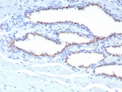 SLC45A3 Antibody for IHC. Immunohistochemistry analysis of Prostein / SLC45A3 antibody staining in FFPE human prostate tissue using clone SLC45A3/7653. Strong cytoplasmic and perinuclear staining is observed in prostate glandular epithelial cells outlining luminal structures, consistent with Golgi-associated localization of Prostein, while surrounding stromal components remain largely negative. The staining highlights polarized epithelial organization and secretory cell morphology within prostate glands, supporting the role of SLC45A3 as a Golgi-associated protein involved in intracellular trafficking in prostate epithelium. Heat-induced epitope retrieval was performed in pH 9 Tris-EDTA buffer for 20 minutes followed by cooling prior to antibody incubation.