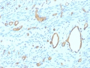 CD34 Antibody Uterus IHC rHPCA1/8500. Immunohistochemistry analysis of CD34 expression in FFPE human uterus tissue using a Microvessel Density Marker Antibody, clone rHPCA1/8500, demonstrates distinct membranous HRP-DAB brown staining in endothelial cells outlining capillaries and small vessels, enabling clear identification and enumeration of microvascular structures within the tissue, while surrounding stromal and epithelial cells remain largely negative. The staining pattern supports accurate assessment of microvessel density and vascular distribution. HIER: boil tissue sections in pH 9 10mM Tris with 1mM EDTA for 20 min and allow to cool before testing.