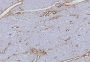 CD34 Antibody Uterus IHC HPCA1/8333R. Immunohistochemistry analysis of CD34 expression in FFPE human uterus tissue using an Endothelial Cell Marker Antibody, clone HPCA1/8333R, demonstrates membranous HRP-DAB brown staining in vascular endothelial cells outlining small vessels and capillary networks within the endometrial stroma and myometrial tissue, while surrounding stromal and smooth muscle cells remain largely negative. The staining pattern supports clear identification of endothelial cells and visualization of uterine vascular architecture. HIER: boil tissue sections in pH 9 10mM Tris with 1mM EDTA for 20 min and allow to cool before testing.