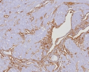 CD34 Antibody Uterus IHC HPCA1/4393R. Immunohistochemistry analysis of CD34 expression in FFPE human uterus tissue using a Hematopoietic Stem Cell Marker Antibody, clone HPCA1/4393R, demonstrates membranous HRP-DAB brown staining in vascular endothelial cells outlining small vessels and capillary networks within the stromal compartment, while surrounding uterine stromal and smooth muscle cells remain largely negative. The staining pattern highlights endothelial-lined structures and reflects CD34 expression within vascular-associated compartments, consistent with its role as a marker of progenitor and endothelial cell populations. HIER: boil tissue sections in pH 9 10mM Tris with 1mM EDTA for 20 min and allow to cool before testing.