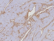 CD34 Antibody Uterus IHC HPCA1/8353R. Immunohistochemistry analysis of CD34 expression in FFPE human uterus tissue using a Vascular Marker Antibody, clone HPCA1/8353R, reveals membranous HRP-DAB brown staining in endothelial cells forming elongated and branching vascular structures throughout the stromal and myometrial regions, while adjacent smooth muscle and stromal cells remain largely negative. The staining pattern highlights interconnected vessel networks and supports detailed visualization of uterine vascular organization. HIER: boil tissue sections in pH 9 10mM Tris with 1mM EDTA for 20 min and allow to cool before testing.