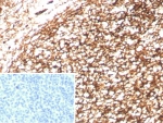 Complement Receptor 1 Antibody Tonsil IHC. Immunohistochemistry of Complement Receptor 1 / CR1 in FFPE human tonsil tissue using recombinant rabbit monoclonal Complement Receptor 1 antibody, clone CR1/8833R. HRP-DAB brown staining highlights a dense reticular follicular dendritic cell network within germinal centers, consistent with complement-mediated immune complex retention, while surrounding lymphocytes show minimal staining and nuclei are counterstained blue. Inset: PBS was used in place of primary antibody as a negative control to confirm specificity of staining. Heat induced epitope retrieval was performed by boiling tissue sections in pH 9 10 mM Tris with 1 mM EDTA for 20 min followed by cooling prior to staining.