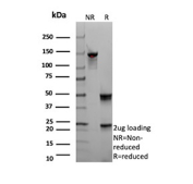 INSM1 Antibody Recombinant Mouse MAb (clone rINSM1/6287). SDS-PAGE analysis of purified INSM1 Antibody Recombinant Mouse MAb (clone rINSM1/6287) under non-reduced (NR) and reduced (R) conditions confirms antibody purity and structural integrity. Under non-reducing conditions the intact antibody migrates at approximately 150 kDa, consistent with the expected size of a full IgG molecule. Under reducing conditions the antibody resolves into bands corresponding to the IgG heavy chain (~50 kDa) and light chain (~25 kDa). Two micrograms of purified antibody were loaded per lane for analysis.