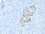 IA1 Antibody / Insulinoma-associated protein 1 (clone INSM1/7992R). Immunohistochemistry analysis of Insulinoma-associated protein 1 (INSM1) in formalin-fixed, paraffin-embedded human pancreas tissue using IA1 antibody (clone INSM1/7992R). Distinct nuclear HRP-DAB staining highlights INSM1-positive endocrine cells within pancreatic islets, consistent with the nuclear localization of this neuroendocrine transcription factor. Surrounding exocrine pancreatic tissue remains largely negative, producing clear contrast between endocrine and non-endocrine compartments. Antigen retrieval was performed by boiling tissue sections in 10 mM Tris with 1 mM EDTA, pH 9, for 20 minutes followed by cooling prior to antibody incubation.