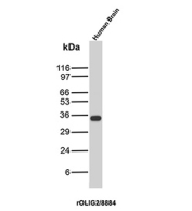 OLIG2 Antibody for WB Human Brain. Western blot analysis of Oligodendrocyte transcription factor 2 (OLIG2) expression in human brain tissue lysate using OLIG2 antibody clone rOLIG2/8884. Lane 1: human brain lysate. A band is detected at approximately 32â34 kDa, consistent with the predicted molecular weight of OLIG2. The clear detection at the expected size supports the use of this clone as an OLIG2 antibody for western blot applications in neural tissue analysis.