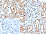 MX1 Antibody Human Kidney IHC. Immunohistochemical staining of FFPE human kidney tissue using MX1 Antibody / Antiviral Response Protein Antibody (clone MX1/7527) demonstrates moderate to strong granular cytoplasmic HRP-DAB brown staining throughout renal tubular epithelial cells, with comparatively limited staining within glomerular structures. MX1 (Myxovirus Resistance Protein 1) is an interferon-inducible dynamin-like GTPase that functions as a key mediator of innate antiviral immunity and host defense. As a downstream effector of interferon signaling pathways, MX1 contributes to antiviral cellular responses and serves as a widely utilized marker of interferon-regulated activity. The observed tubular staining pattern is consistent with expression of MX1 in epithelial cell populations and supports the utility of this antibody for immunohistochemical detection of interferon-responsive proteins in human tissues. Inset: PBS was used in place of the primary antibody as a negative control. HIER: boil tissue sections in pH 9, 10 mM Tris with 1 mM EDTA for 20 minutes and allow to cool before testing.