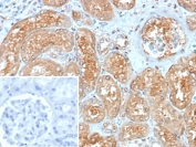 Myxovirus Resistance Protein 1 Antibody Human Kidney IHC. Immunohistochemical staining of FFPE human kidney tissue using Myxovirus Resistance Protein 1 Antibody / MX1 Antibody (clone MX1/7530) demonstrates strong granular cytoplasmic HRP-DAB brown staining throughout renal tubular epithelial cells, while glomerular structures show comparatively limited staining. MX1 is an interferon-inducible dynamin-like GTPase that functions as a key mediator of innate antiviral immunity and host defense. As a downstream effector of interferon signaling pathways, MX1 contributes to cellular antiviral responses by restricting viral replication and supporting interferon-regulated immune mechanisms. The observed tubular staining pattern is consistent with expression of MX1 in epithelial cell populations involved in innate immune surveillance and antiviral response pathways. Inset: PBS was used in place of the primary antibody as a negative control. HIER: boil tissue sections in pH 9, 10 mM Tris with 1 mM EDTA for 20 minutes and allow to cool before testing.