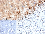 Immunohistochemistry analysis of S100B / Brain Injury Biomarker antibody (clone S100B/4152) in human brain tissue. FFPE human brain demonstrates strong cytoplasmic and nuclear HRP-DAB brown staining in astrocyte-like cells distributed throughout the parenchyma, consistent with S100B expression. Staining highlights cells with branching processes characteristic of astroglial morphology, while neuronal cell bodies show comparatively weaker signal. Nuclei are counterstained blue. The inset image represents a secondary antibody negative control in which PBS was used in place of the primary antibody and shows absence of specific staining. Heat induced epitope retrieval was performed by boiling tissue sections in 10 mM Tris with 1 mM EDTA, pH 9.0, for 20 minutes followed by cooling prior to immunostaining.